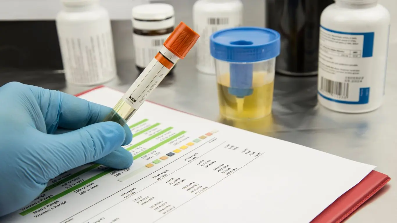Urine Drug Test cups